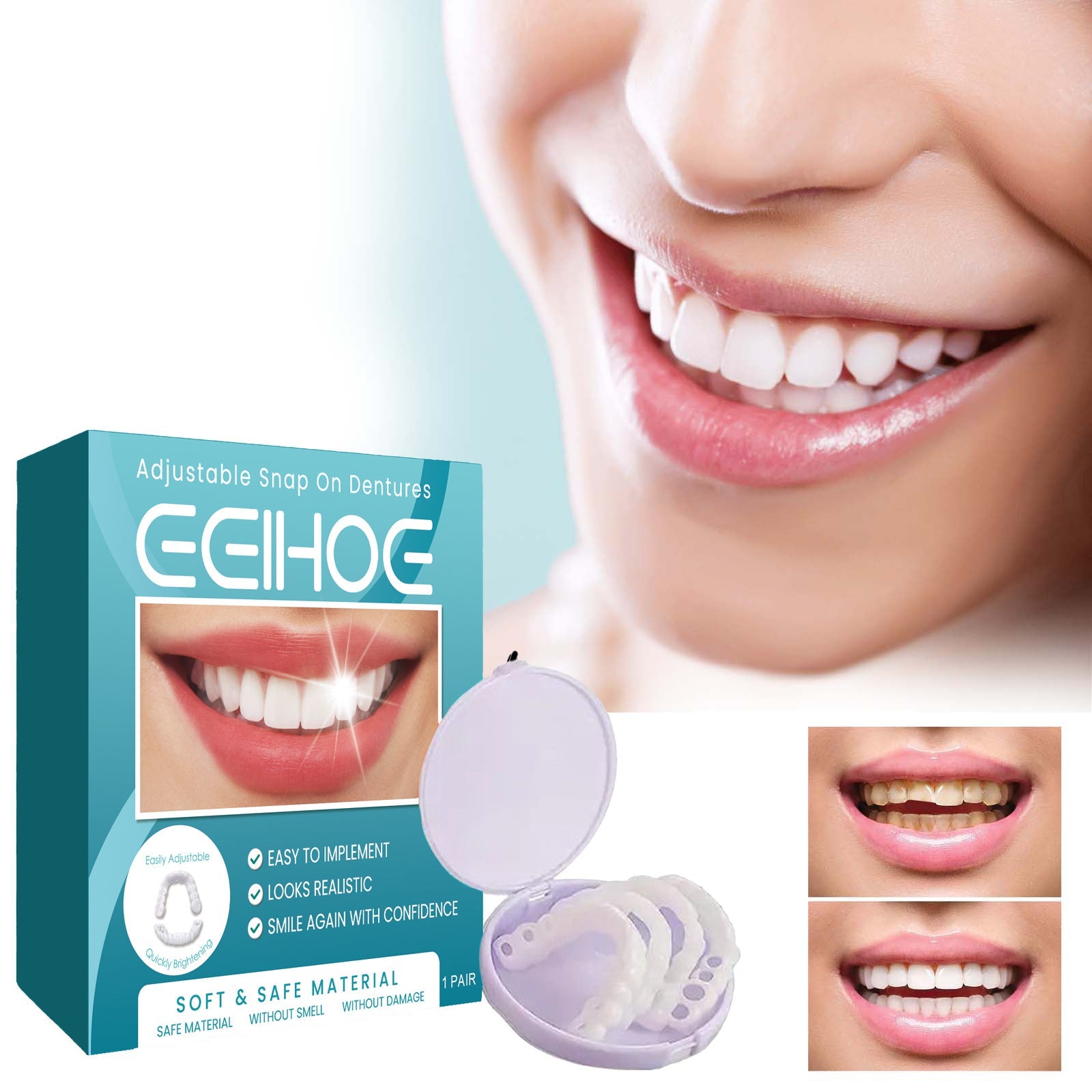 EELHOE Adjustable Buckle Denture, Temporary Fillings Interdental